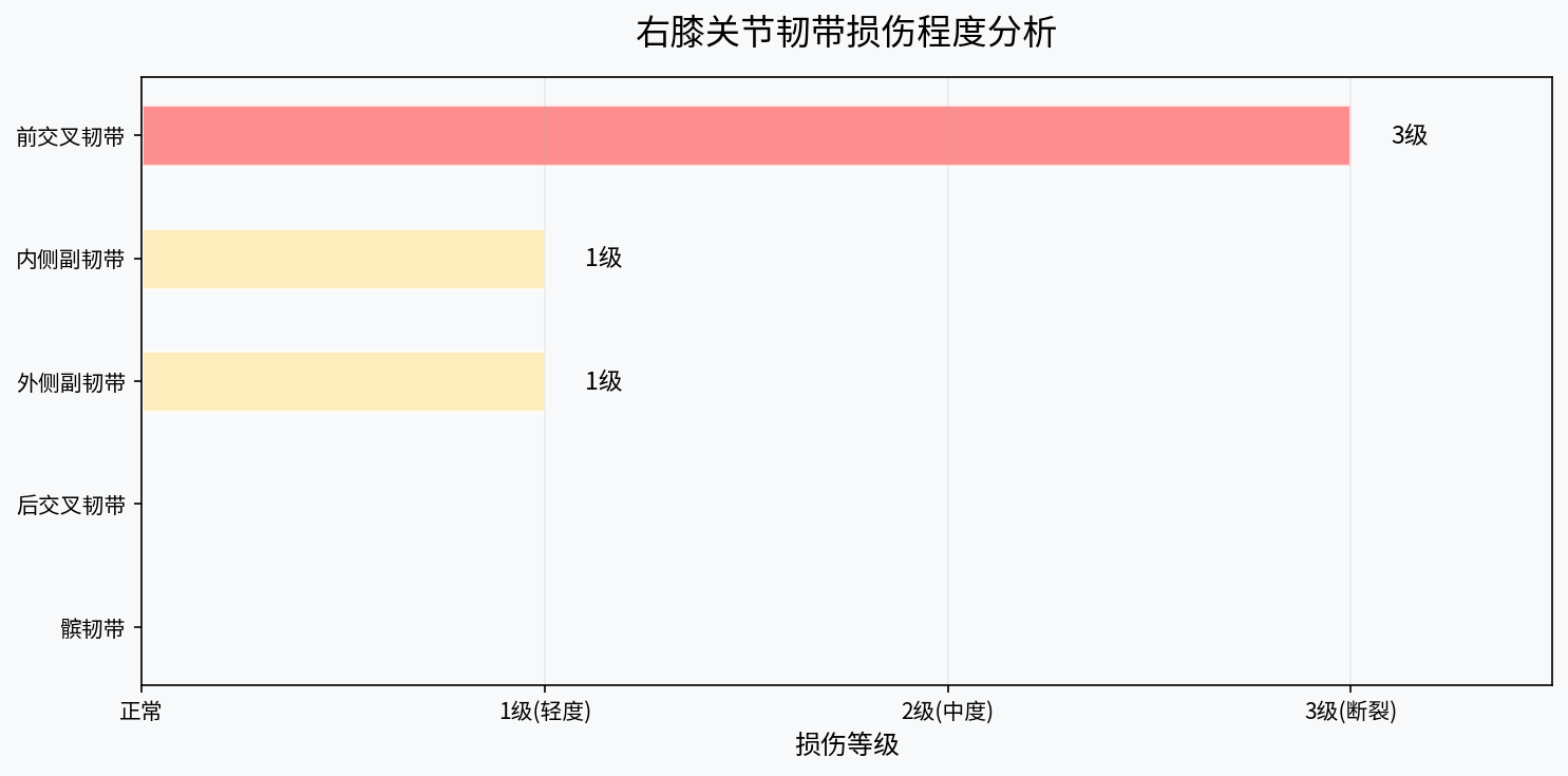 韧带损伤程度分析图